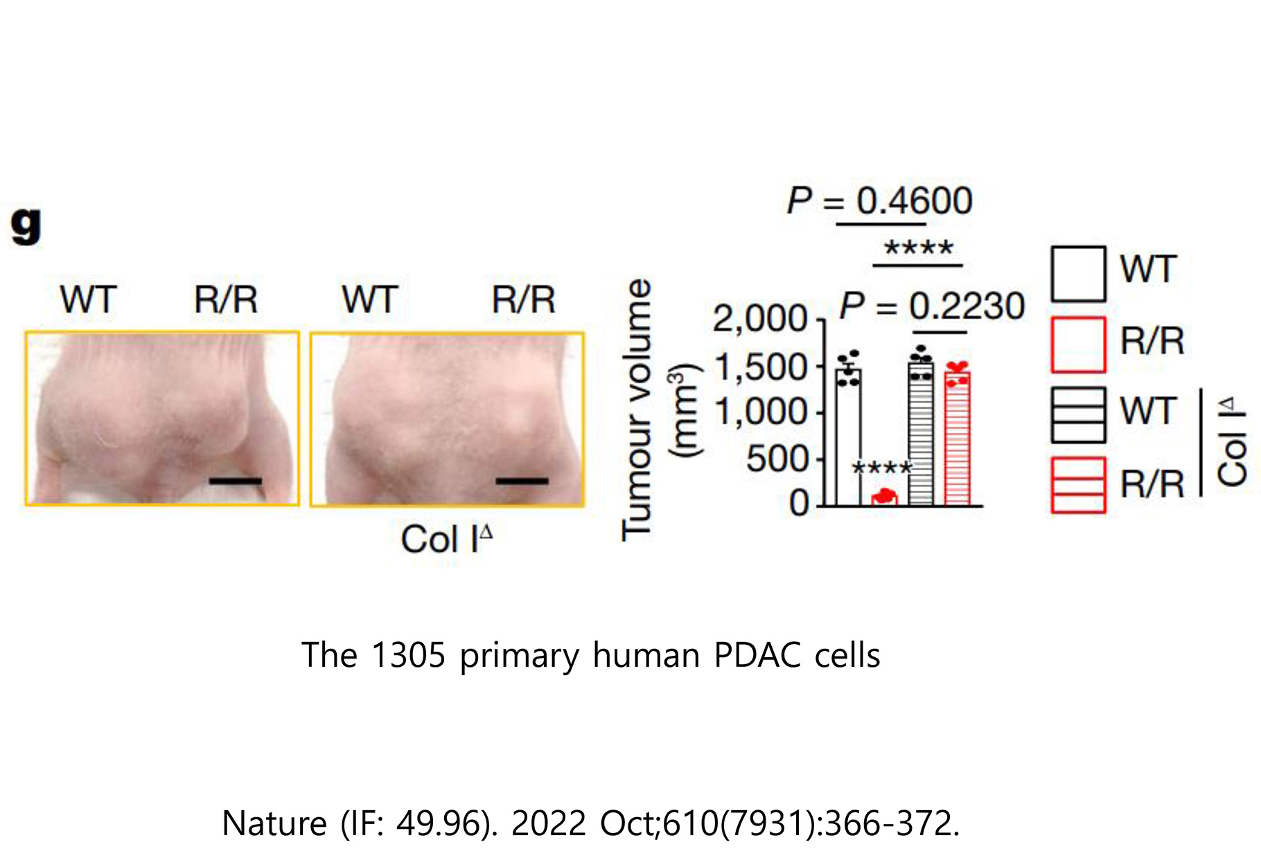 Pancreatic cancer histology